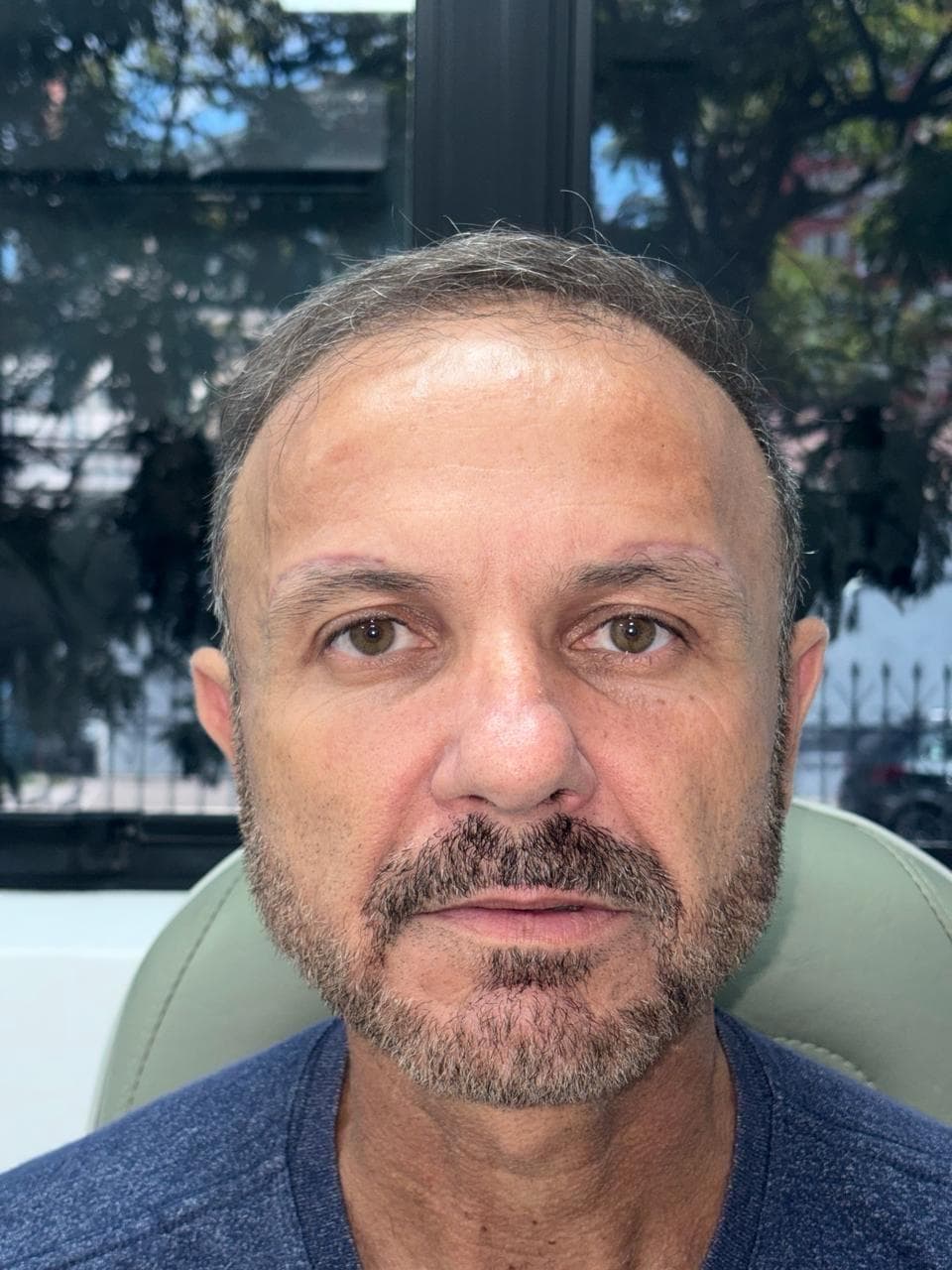 Frente